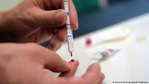 Nuevo test de VIH da respuesta casi inmediata | Ciencia y Ecología | DW |  20.06.2018